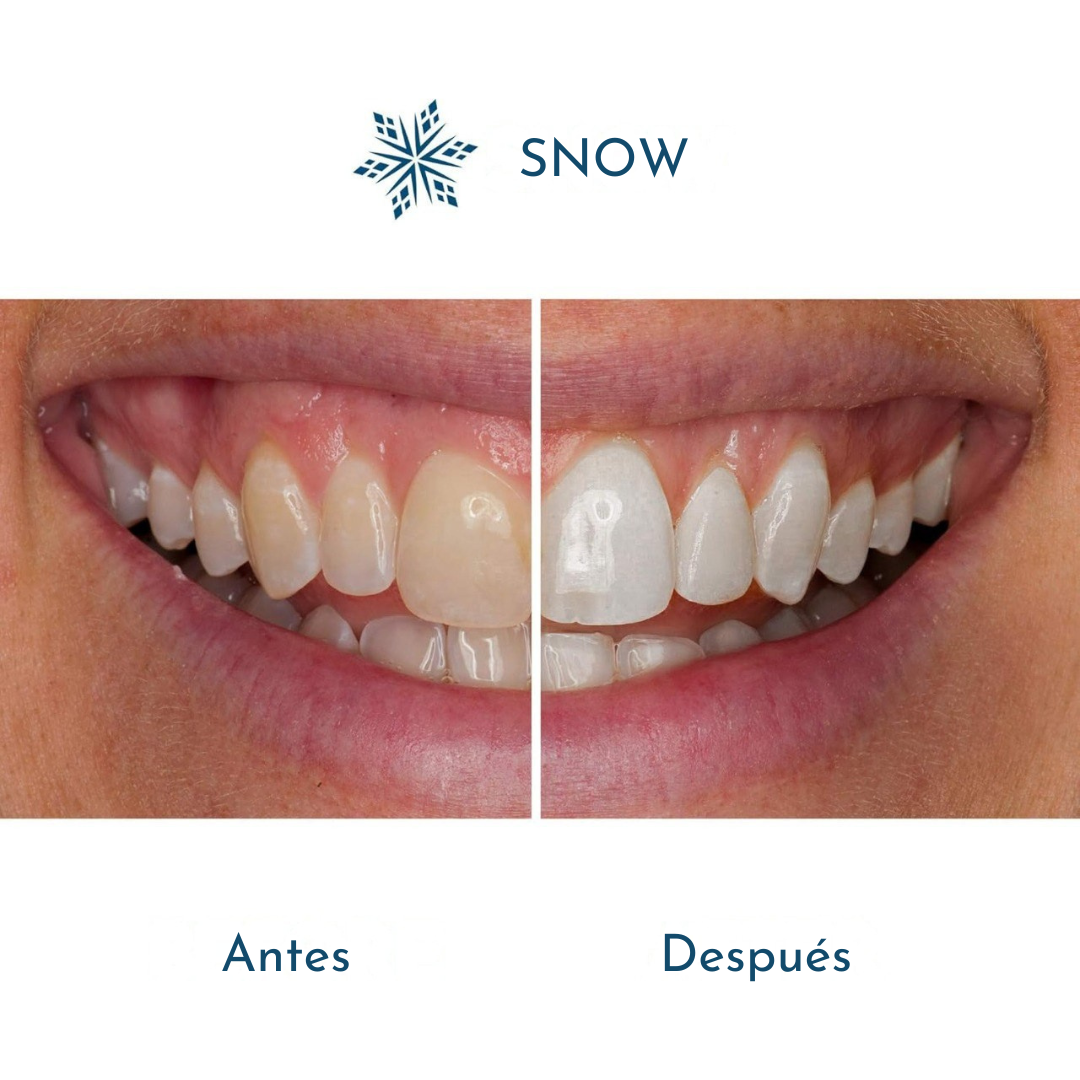 Lápiz Blanqueador de SonrisasTM